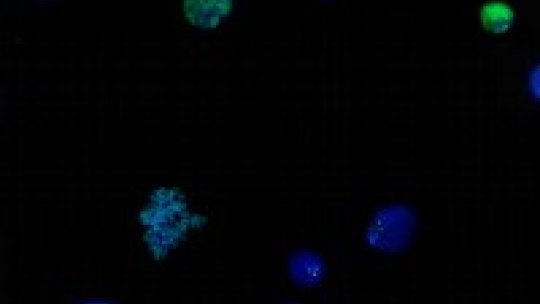 Els centròmers (a la imatge) són essencials durant la segregació de cromosomes i la proliferació cel·lular. la seva funció ve determinada epigenèticament per una variant de la histona H3. Imatge cedida per Olga Moreno, IRB Barcelona