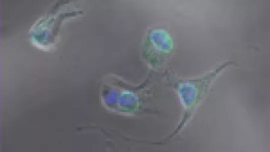 Macrophages digesting cellular remains © A Celada's group. IRB Barcelona