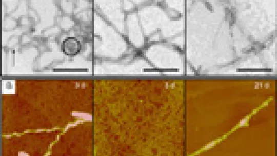 Different stages during the process of amyloid fibril formation<br /> (A)Electron microscope images after 2, 6 and 21 days of aggregation <br />(B)Atomic force microscope images after 3 and 21 days of aggregation
