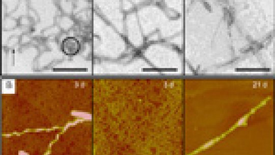 Different stages during the process of amyloid fibril formation<br /> (A)Electron microscope images after 2, 6 and 21 days of aggregation <br />(B)Atomic force microscope images after 3 and 21 days of aggregation