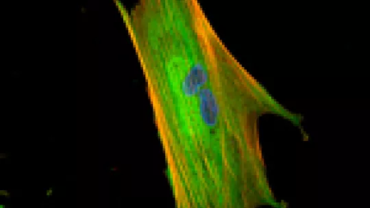 Stroma cells, such as the fibroblasts in this image, help colon cancer cells to metastasize. © E. Batlle lab, IRB Barcelona. Autor: Alexandre Calon
