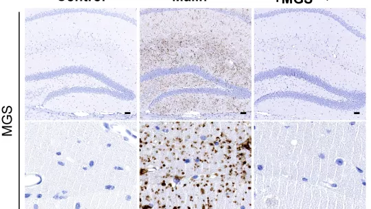 Cuerpos de Lafora en cortes de cerebro (hipocampo). Los cuerpos que se acumulan en la enfermedad desaparecen cuando se elimina la capacidad de los astrocitos de producir glucógeno.