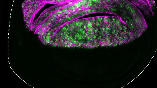p53 target genes (green) are upregulated in undergrowing cell populations (magenta).