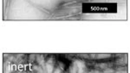 Although these two types of fibers are formed by the same protein, the ones above are toxic and the ones below are not.