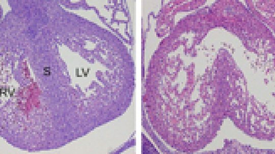 Functional myocardium (S) from a normal mouse embryo (left). The absence of p38&#945. and p38&#946. proteins produces myocardium lacking the heart septal (right).