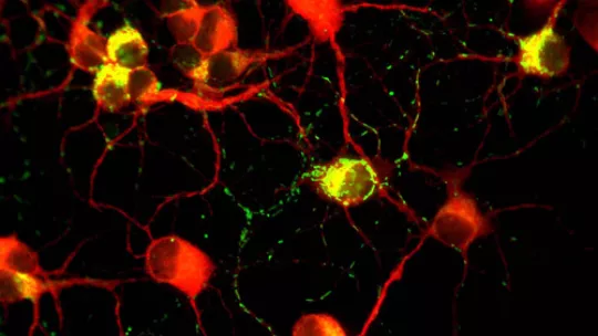 Neuronas de ratón con el gen de la frataxina transferido. En amarillo, localización de la proteína frataxina en las neuronas(Imagen: Laboratorio de Díaz-Nido)