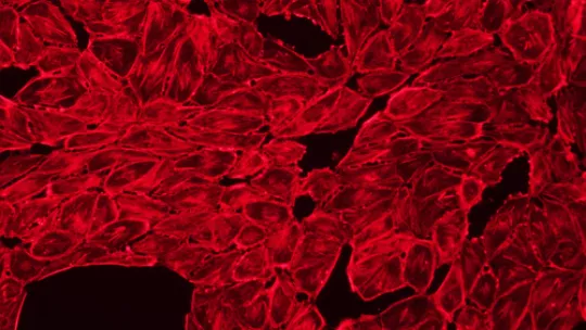 In black, gaps between blood vessel cells caused by signalling from tumour cells. Tumour cells cross these gaps in order to colonize the lung. (Microscope image: J Urosevic, IRB)