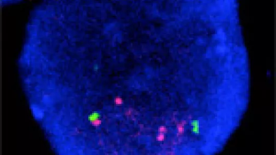 Image of a tumour cells with multiple copies of the Her2 gene shown in red. © IRB Barcelona. R. Gomis