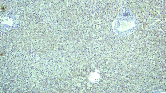 Tissue sample from healthy human liver (IRBBarcelona/IDIBAPS)