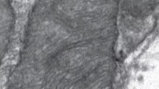 (Microscopia electrónica) Mitocondria de músculo sano (D. Sebastián, IRB Barcelona, CIBERDEM)