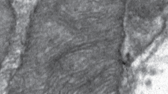 (Electron microscopy) A normal muscle mitochondrion (D. Sebastián, IRB Barcelona, CIBERDEM)