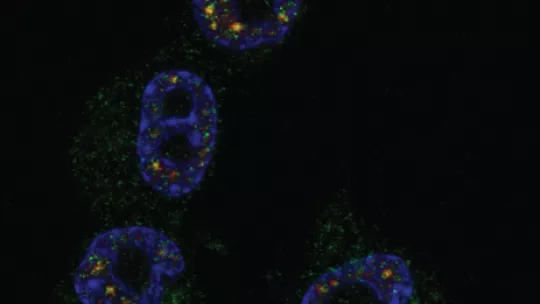 Green shows the localization of CPEB1 in four tumor cells and blue the nuclei. © Bava, Méndez, IRB Barcelona