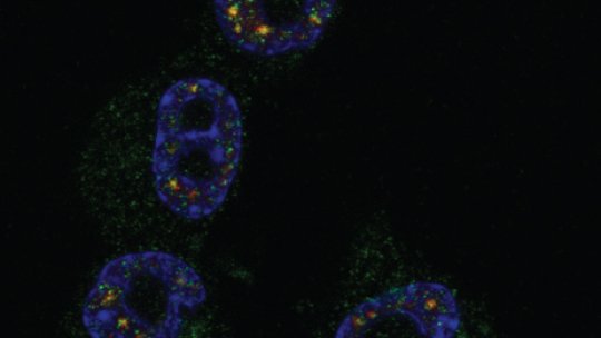 Green shows the localization of CPEB1 in four tumor cells and blue the nuclei. © Bava, Méndez, IRB Barcelona
