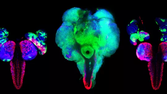 Proliferative and invasive capacity of tumour cells (centre) compared to normal cells (left) and effect of TRAMETINIB treatment, which reduces the invasive capacity and tumoural load (right). Marco Milán, IRB Barcelona.