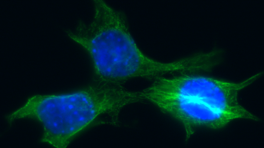 Imagen de células de cáncer de mama derivadas de un tumor de ratón (en azul: núcleo, en verde: tubulina) Autor: Begoña Cánovas, IRB Barcelona 