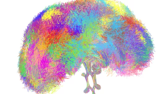 Illustrated view of the different conformations adopted by a flexible small molecule. Colours represent different ensembles of conformations.