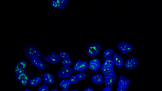 Nuclei of metastatic breast cancer cells showing the protein MSK1 in green (Author: Cristina Figueras-Puig, IRB Barcelona)