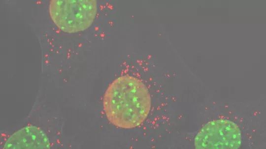 El estrés del ADN mitocondrial (en rojo) inicia la respuesta inflamatoria en ausencia de OPA1 en células musculares de ratón (en verde, los núcleos). Aida Rodríguez, IRB Barcelona