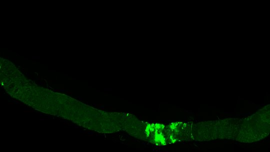 La supresión del gen Mirror limita la formación de tumores en el intestino de Drosophila (O Martorell, IRB Barcelona)