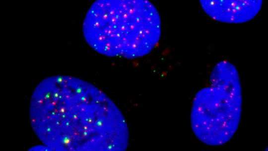 Cancer cells with TLK inhibition show replication intermediates (green) at chromosome ends (red) - (IRB Barcelona)