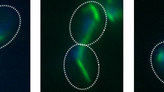 Cèl•lules de llevat Saccharomyces cerevisiae en la fase de mitosis del cicle cel•lular