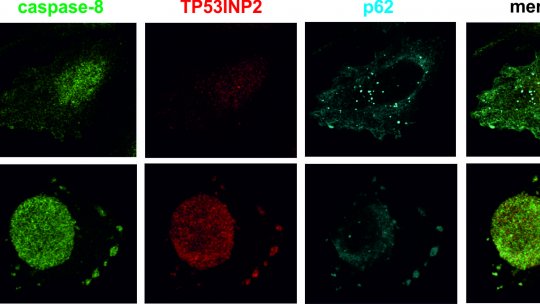 Diferents localitzacions de les proteïnes involucrades en apoptosi en condicions basals (Ctrl) i amb inducció dels receptors de mort cel·lular amb TRAIL. Saška Ivanova, IRB Barcelona