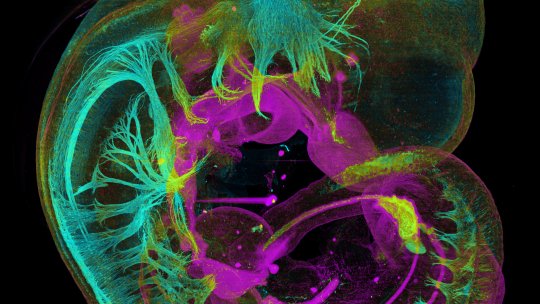 In this mouse embryo structures can be observed that contain neurofilament, stained cyan, and E-Cadherin, in magenta, showing, respectively, the nervous system and internal organs (Authors:  Jim Swoger, Jürgen Mayer, Laura Quintana. CRG 2017)