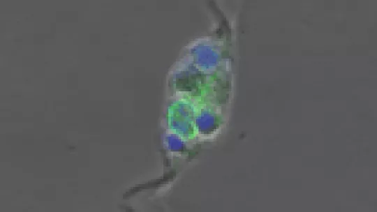 Macrophages are key cells in the immune system. Among other functions, they remove debris, pathogens or foreign agents from our body. In the image, a macrophage (with nucleus in green) has swallowed fragments of dead cells (in blue)(c) Maria Serra