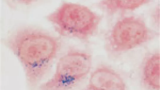 Cells with magnetic nanoparticles inside (in blue)