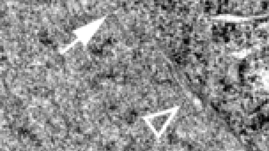 Without MEL-28, the embrane that encloses the cell?s nucleus doesn?t completely seal, allowing the DNA to mix with the cytoplasm.