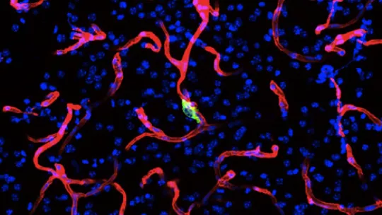 A cancer cell (green) crosses a blood vessel (red) to enter to the brain tissue. Author: Dr. Manuel Valiente