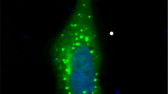CPEB4 liquid-like droplets in the cell cytoplasm (J. Guillén-Boixet, IRB Barcelona)
