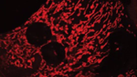 Hepatic cells isolated from healthy mice and mice deficient in Mitofusin 2 (right). Morphology of mitochondria (red), more rounded, is altered in the image on the right
