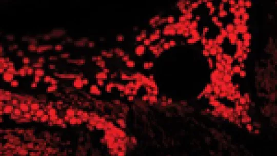 Hepatic cells isolated from healthy mice and mice deficient in Mitofusin 2 (right). Morphology of mitochondria (red), more rounded, is altered in the image on the right