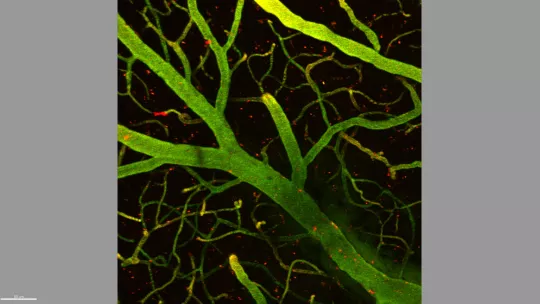 Detalle de 1 mm de cerebro de ratón. En verde, capilares que forman parte de la barrera hematoencefálica y, en rojo, las moléculas que unidas a la lanzadera han conseguido traspasar la barrera y llegar al cerebro (en fondo negro). (Benjamí Oller, IRB)
