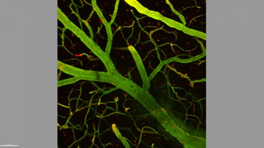 Detall d'1 mm de cervell de ratolí. En verd, capil.lars que formen part de la barrera hematoencefàlica i, en vermell, les molècules que unides a la llançadora han aconseguit traspassar la barrera i arribar al cervell (en fons negre). (Benjamí Oller, IRB)