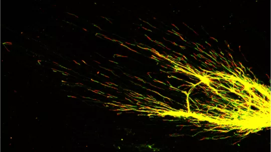 Visión de la replicación del ADN. Regiones de replicación (rojo y verde). Imagen: Jordi Bernués, IRB Barcelona.