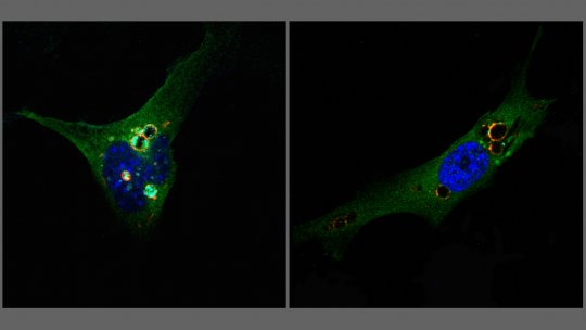 Células de ratón en presencia (izq) o ausencia (dcha.) de la proteína DOR –dentro de las vesículas en naranja. Descubrimienro del mecanismo por el cuál DOR regula a las células de la grasa, y de este modo el desarrollo de la obesidad. (M. Romero, IRB)