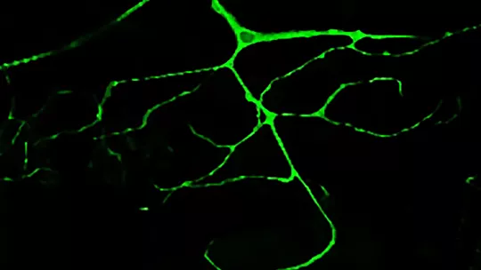 Highly ramificated tracheal cell of a Drosophila larvae marked with GFP. (Delia Ricolo)