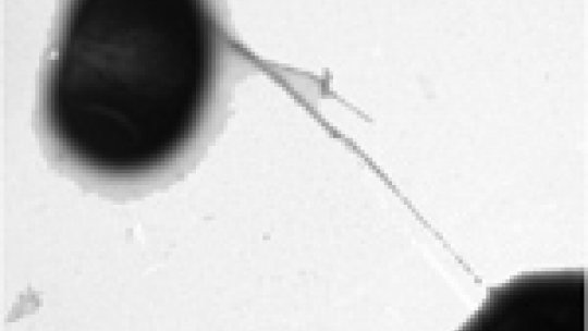 DNA horizontal transmission between two cells of bacteria Escherichia coli. Image: Antonio Juárez (IBEC)