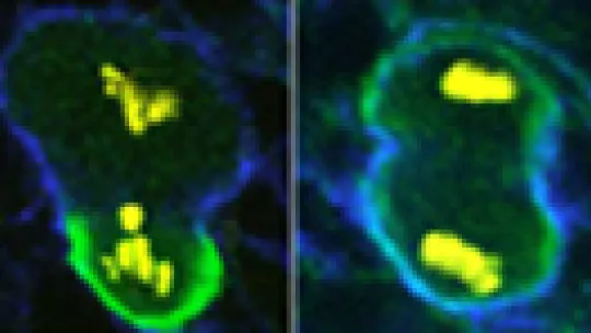 (c)EMBL. Left: Normal dividing neuroblasts create a large new cell and a smaller cell destined to become part of a nerve. Right: If molecules aren't put in the right places, this asymmetric division doesn't occur and a tumor develops.