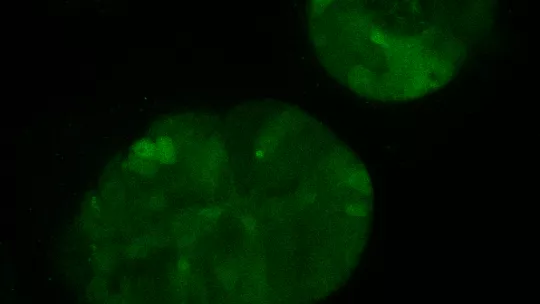 Organoide derivado de paciente diseñado con la tecnología CRISPR/Cas9 para integrar el marcador con EGFP del gen LGR5 (Imagen: G Turon, IRB Barcelona)