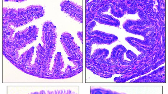 The mice wild type oviduct (left) is lined with multiciliated cells which are completely absent in mice lacking GEMC1 (Berta Terré, IRB Barcelona)