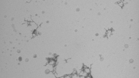 Natàlia Carulla's team studies the associations of beta-amyloid. In the microscopy image, beta-amyloid clusters are observed in in vitro samples. (Bernat Serra-Vidal, IRB Barcelona)