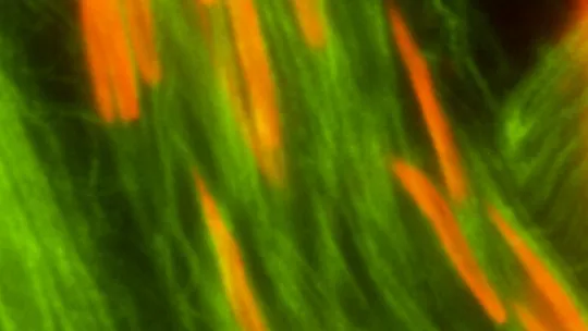  Espermatozoides de Drosophila melanogaster mutante. Las cabezas han perdido la unión con el final de las colas y están desperdigadas. Foto cortesía de S. Llamazares / Gonzalez Lab 