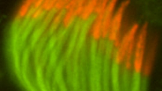 Espermatozoides de Drosophila melanogaster normal. En naranja las cabezas y en verde las colas. Foto cortesía de S. Llamazares / Gonzalez Lab