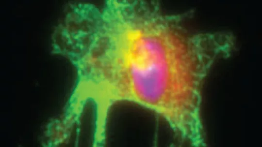 Activated macrophage isolated from mouse intestine. Macrophage marker is shown in green, inflammation marker (iNOS) in red, and nucleus in blue. Author: Catrin Youssif, IRB Barcelona