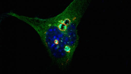 Células de ratón en presencia de la proteína DOR. (M. Romero, IRB Barcelona)