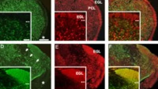 Los progenitores de la zona ventricular del cerebelo que carecen de Ptf1a adquieren el fenotipo de las neuronas granulares. (IRB Barcelona)