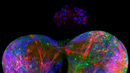 Drosophila's brain exhibiting the ring gland, the equivalent to the human's prothoracic gland, responsible for steroidal hormone production.